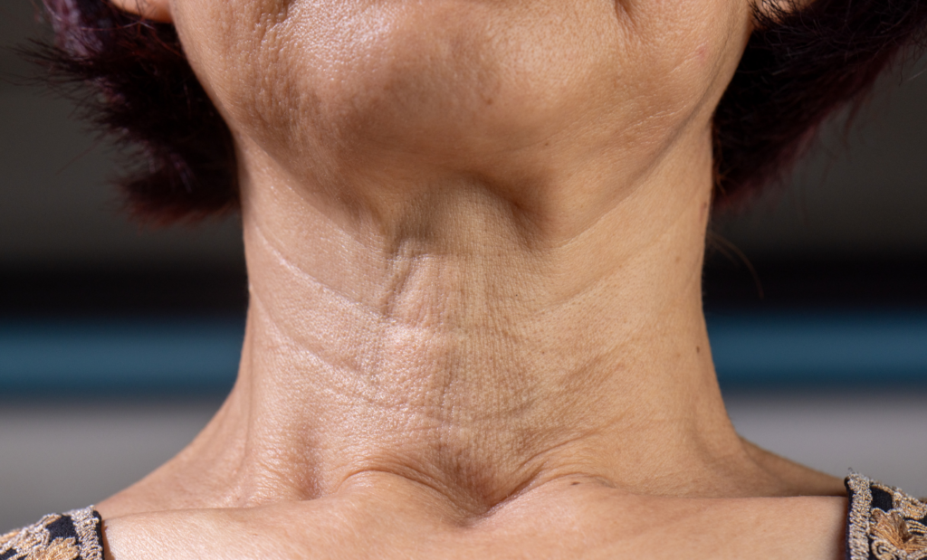 首の皺、たるみがある女性